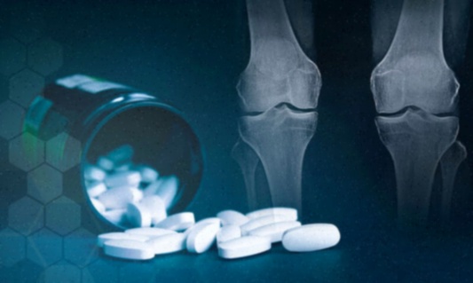 Achat complément alimentaire arthrose