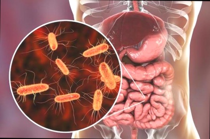 Antiparasitic drugs prix – Fluvermal